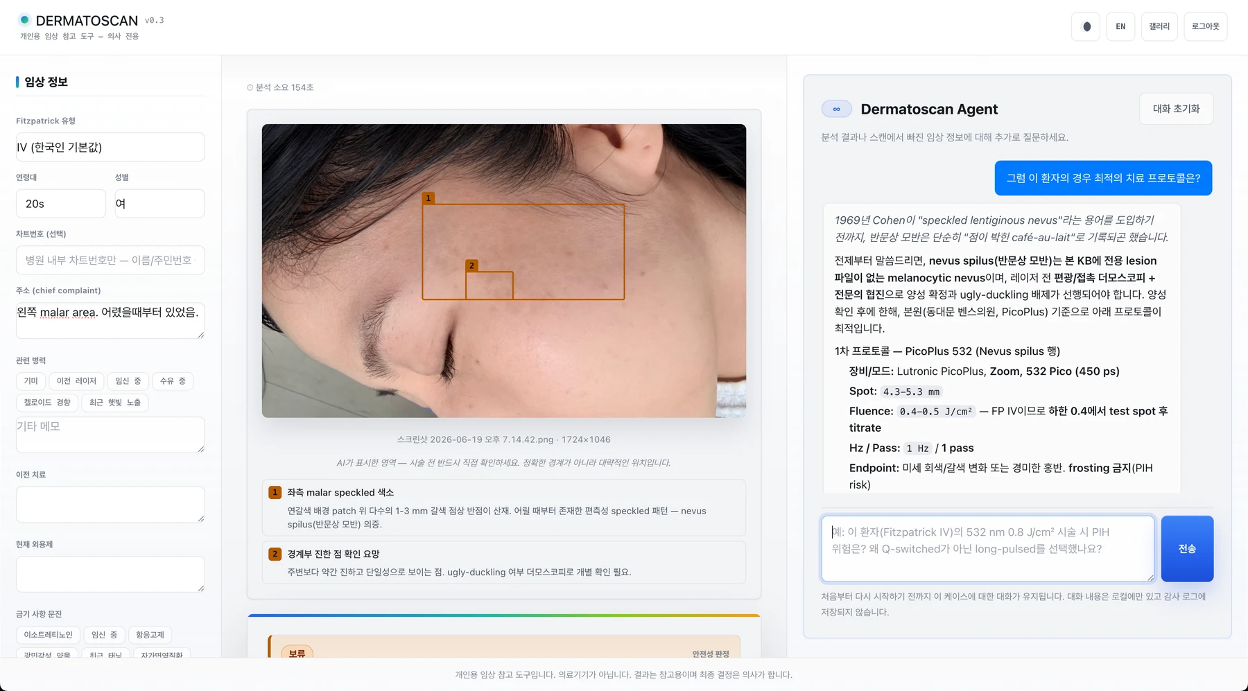 DermatoScan AI Agent consultation screen